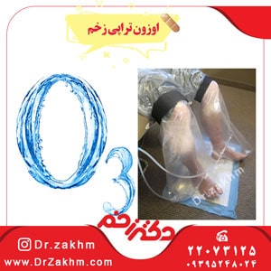 اوزون تراپی زخم