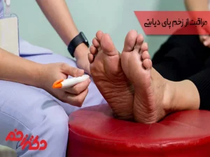 مراقبت از زخم پای دیابتی