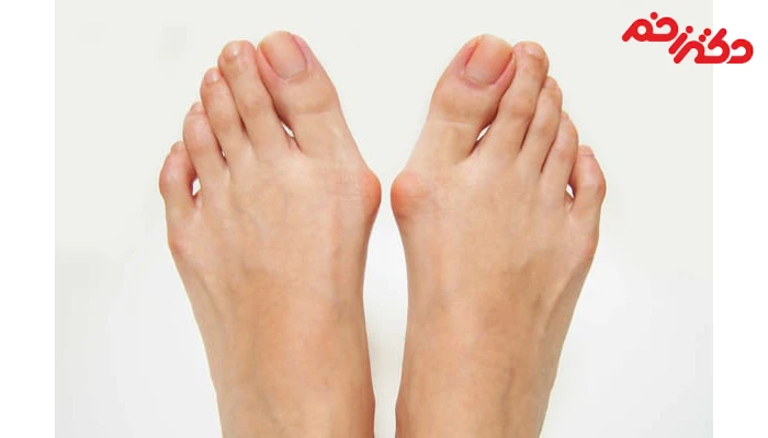 همه چیز درباره دفورمیتی ناخن