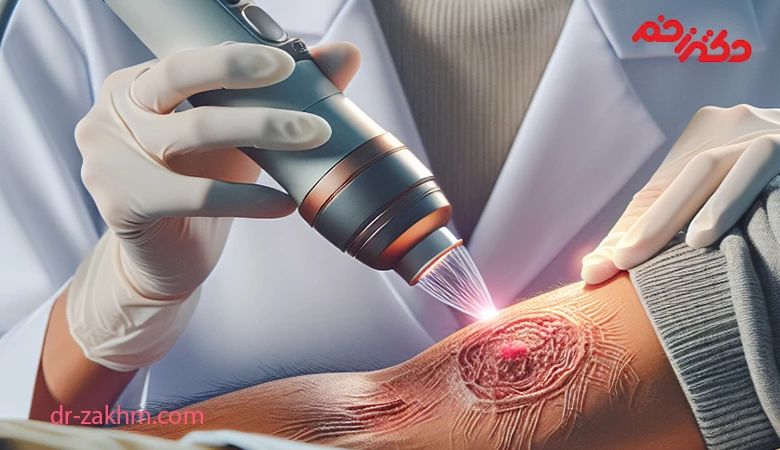 پلاسما تراپی زخم دیابتی چیست؟