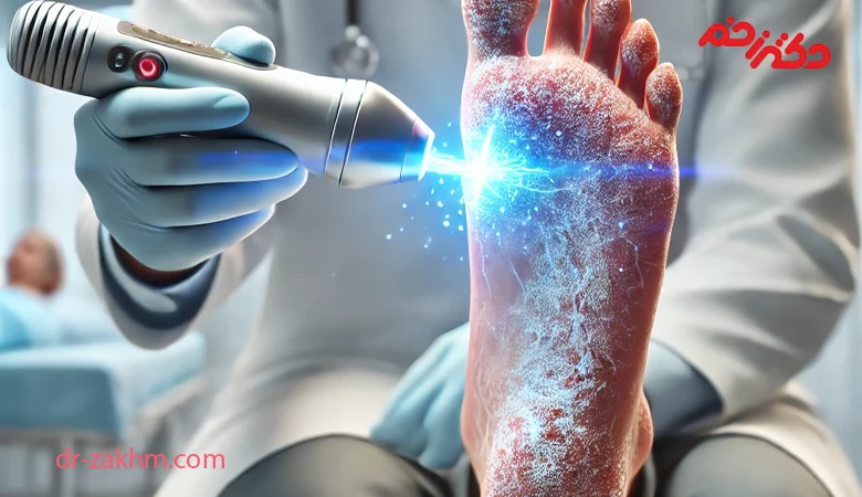 پلاسما تراپی زخم دیابتی