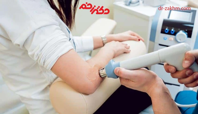 مزایای استفاده از لیزر کم توان در ترمیم زخم