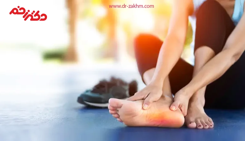 علائم داغ شدن کف پا